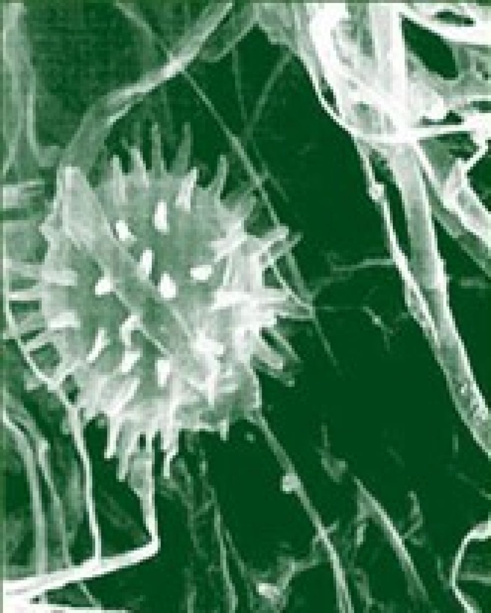 polyversum